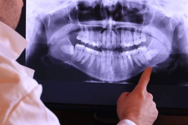Best Urgent Dental Care for Toothaches in Jefferson, TX