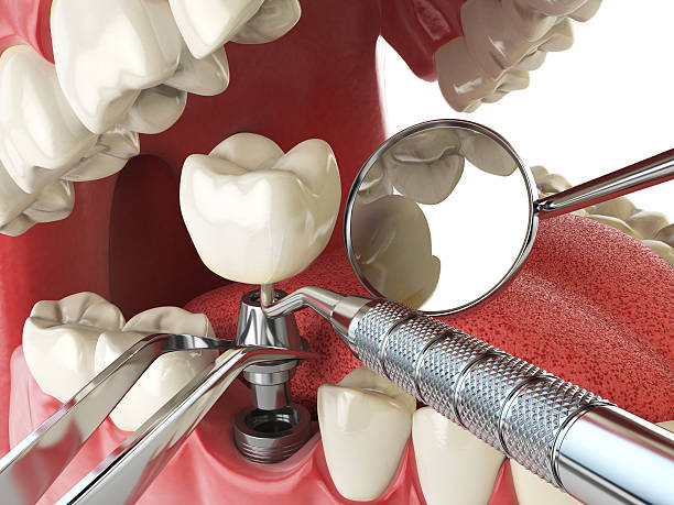 Best Weekend Emergency Dental Services in Jefferson, TX